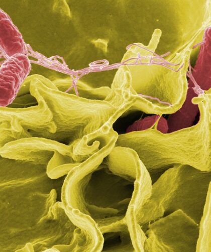 Klorhexidin: Den ultimative løsning på bakterieproblemer